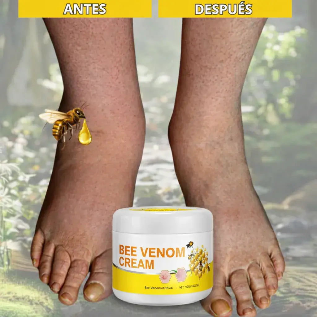 Venom cream Alivia dolores, desinflama y mejora deformaciones Oseas🎁 HOY 30%DCTO