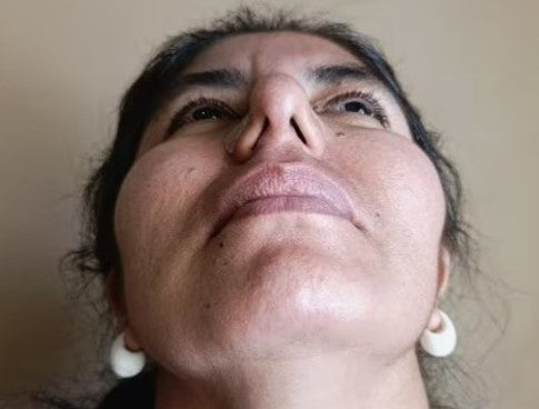 Antes