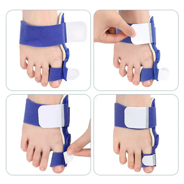 🚨 ¡NUEVO! CORRECTOR AJUSTABLE PARA JUANETES – ADIÓS AL DOLOR 👣