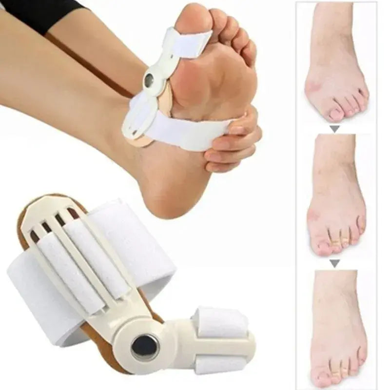 🚨 ¡NUEVO! CORRECTOR AJUSTABLE PARA JUANETES – ADIÓS AL DOLOR 👣