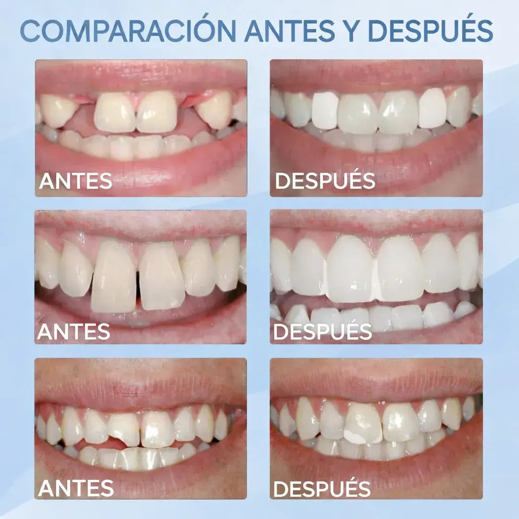 2x1 HOY – Kit Dental Temporal Recupera tu Sonrisa en Minutos 35% DCTO