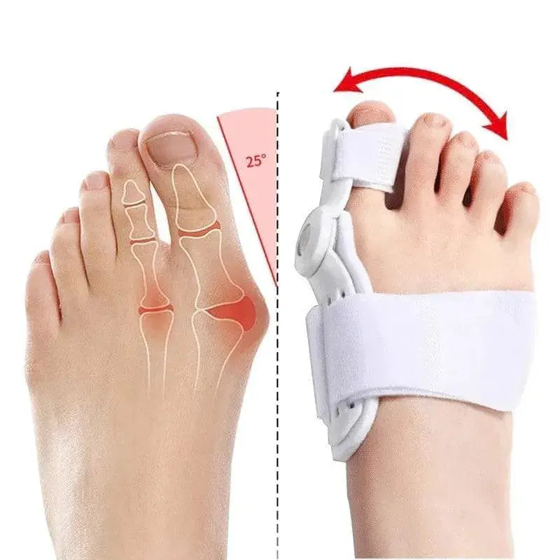 🚨 ¡NUEVO! CORRECTOR AJUSTABLE PARA JUANETES – ADIÓS AL DOLOR 👣