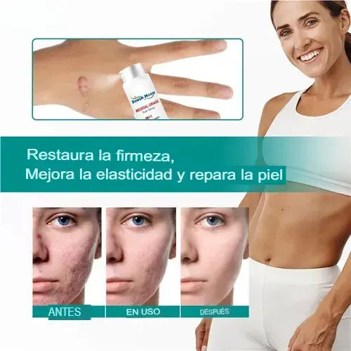 Spray Regenerador South Moon – Elimina cicatrices y renueva la piel con fórmula dermatológica avanzada