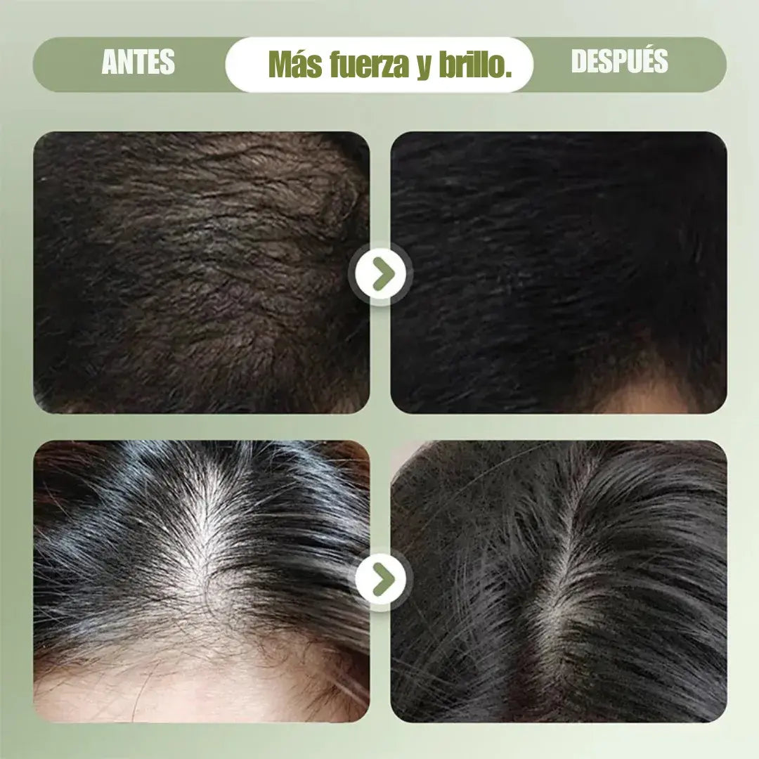 Jabón Capilar de Hierbas Orgánicas 🌿 Fortalece y Nutre desde la Raíz