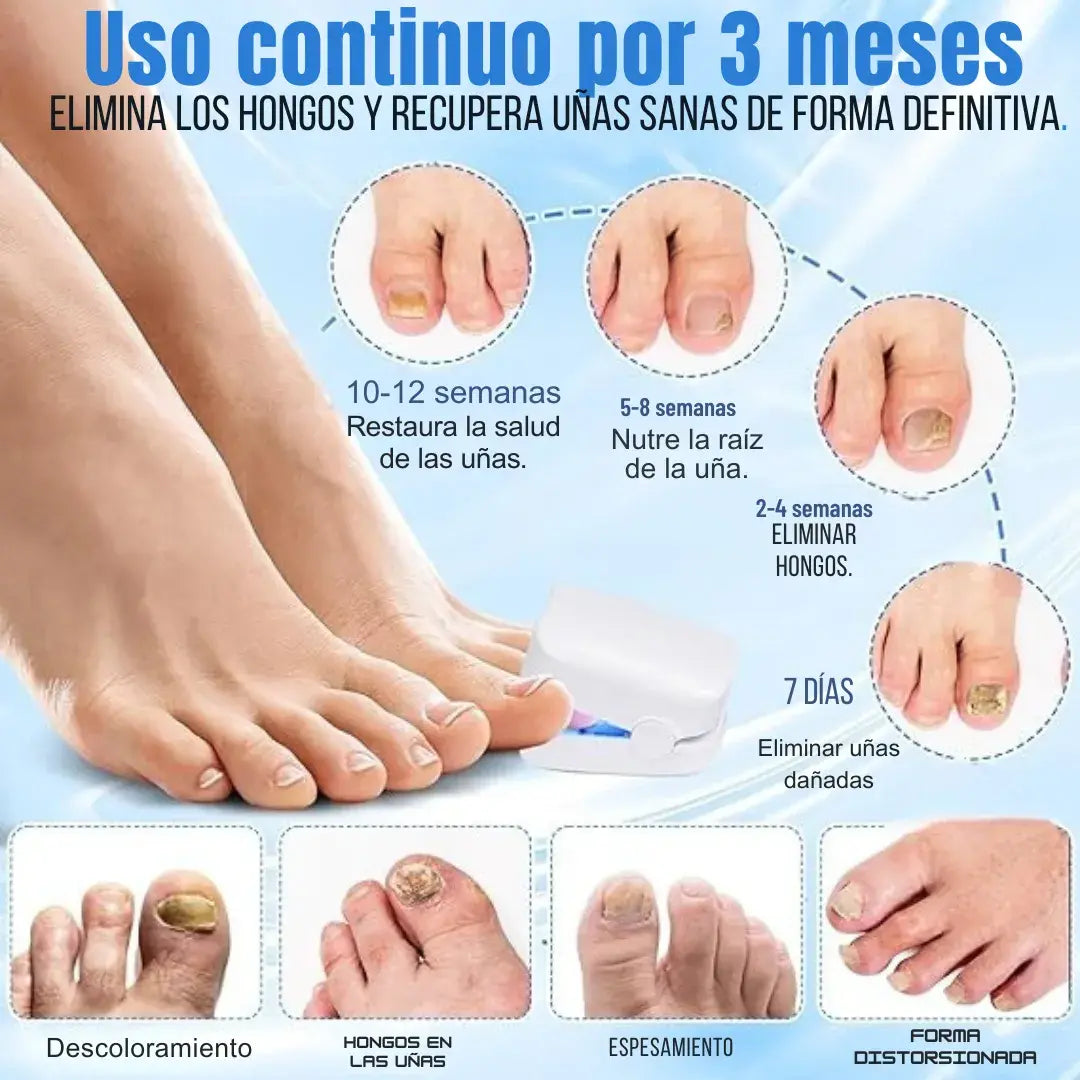 🎁 Compra tu Removedor De Hongos dolccia® y recibe un Cepillo Alisador ¡GRATIS!