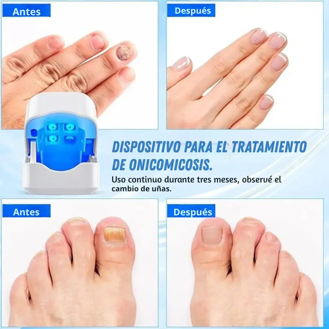 🎁 Compra tu Removedor De Hongos dolccia® y recibe un Cepillo Alisador ¡GRATIS!