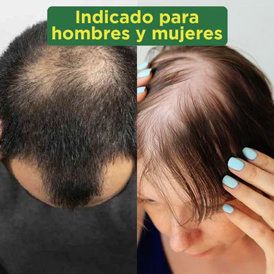⚡️OFERTA TÓNICO DE JENGIBRE UNISEX ⚡️ CRECIMIENTO RÁPIDO