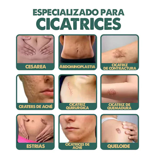 Spray Regenerador South Moon – Elimina cicatrices y renueva la piel con fórmula dermatológica avanzada