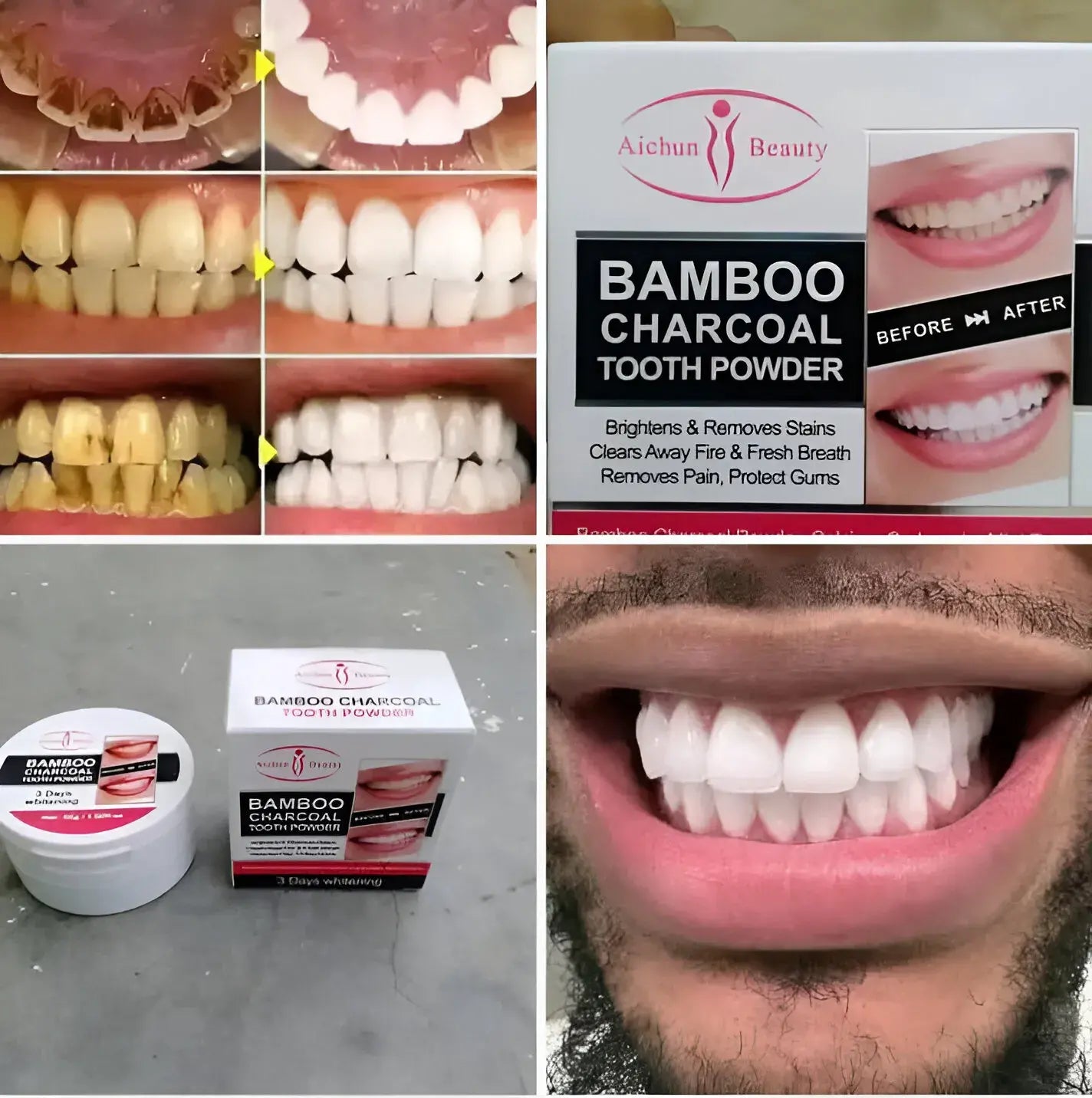 Blanqueador Dental de Lujo con Carbón Activado – Sonrisa Radiante en 3 Días + Aliento Fresco